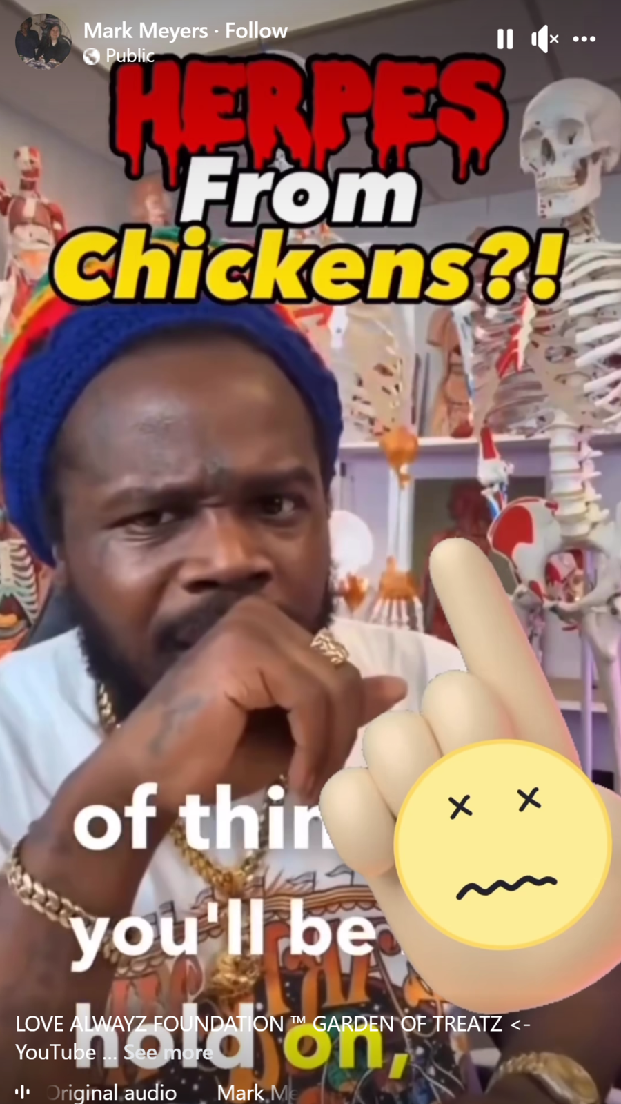 Fact Check Eating Chicken Does NOT Causes Herpes Infections In Humans